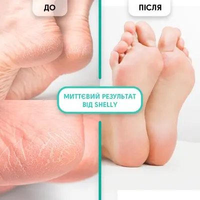 Keratolytic gel for removing calluses and corns Shelly soft blade 200 ml